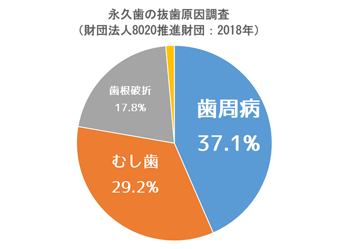 藤井寺駅南口アールズ歯科・歯周病クリニックの歯を守り、残すMI治療