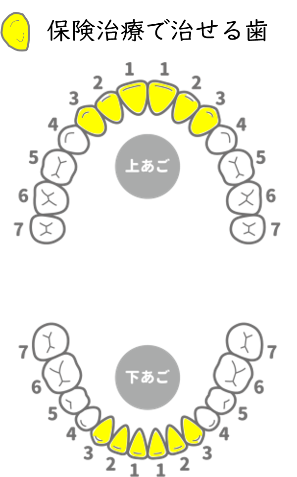 適用範囲