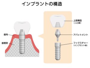 藤井寺駅南口アールズ歯科・歯周病クリニック